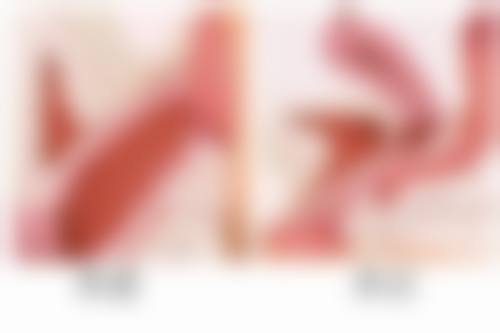 河南大学附属南石医院烧伤整形美容中 心杨洪医生患者评价