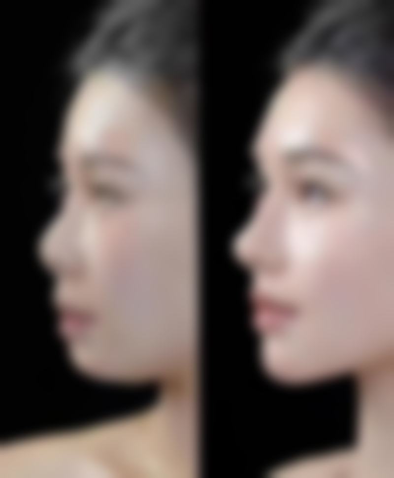 新疆生产建设兵团第十三师红星医院(皮肤美容科)基本信息