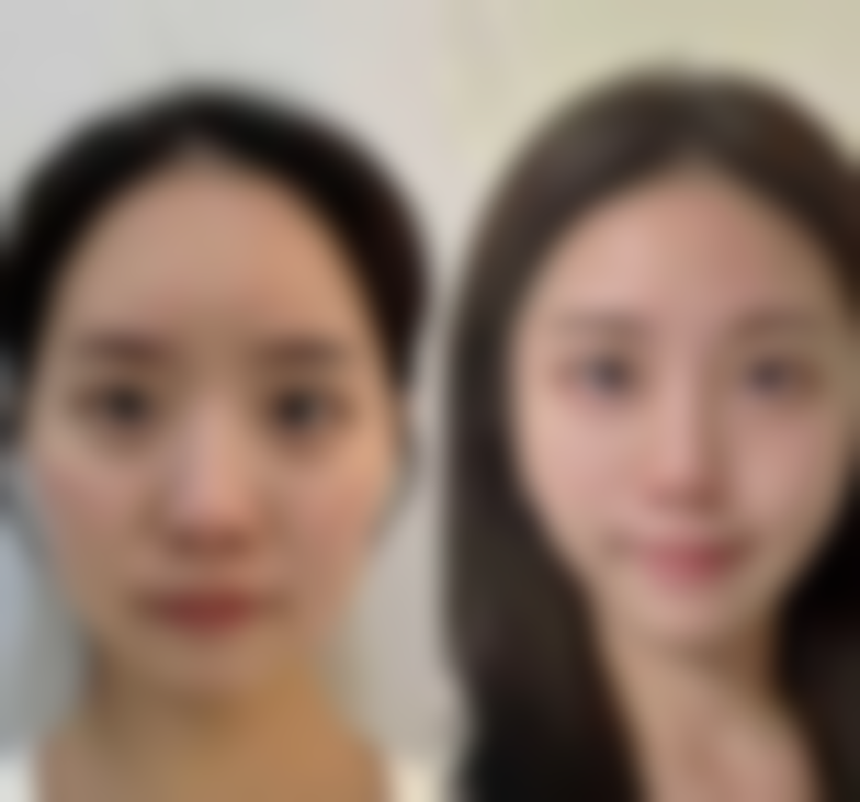 北京澄真医疗美容诊所张桦医生患者评价