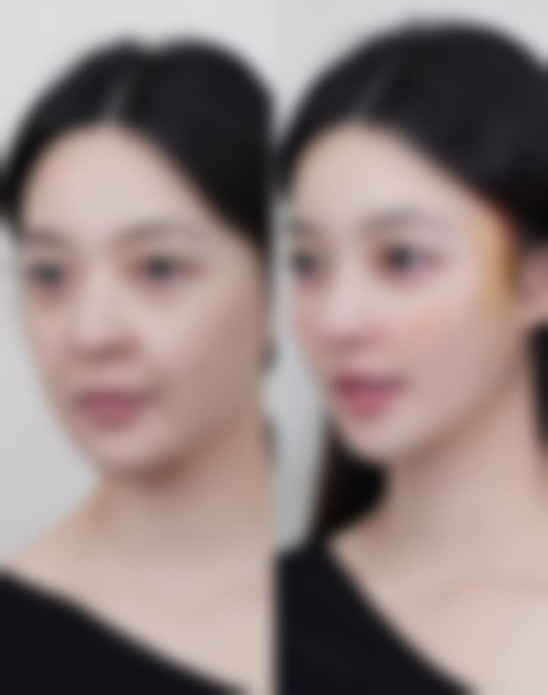 问题九：修复缝合伤口疤痕的时机怎么把握呢？