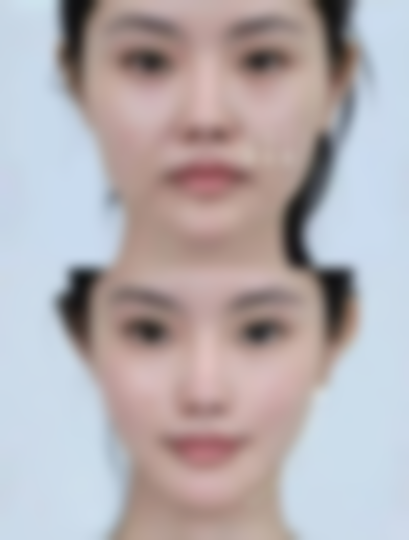 草莓挂掉没活，主要原因是什么？