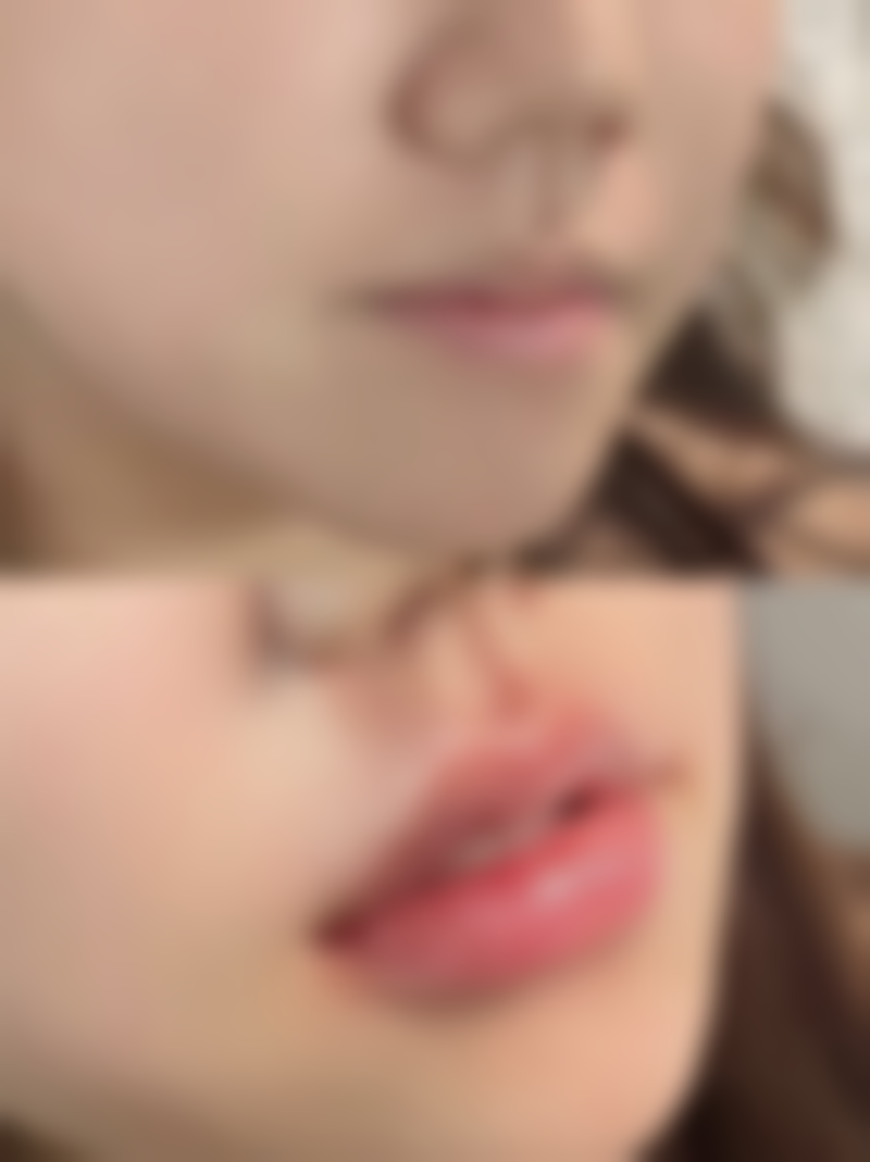 问题四：激光治疗缝合伤口疤痕是怎么回事呢？