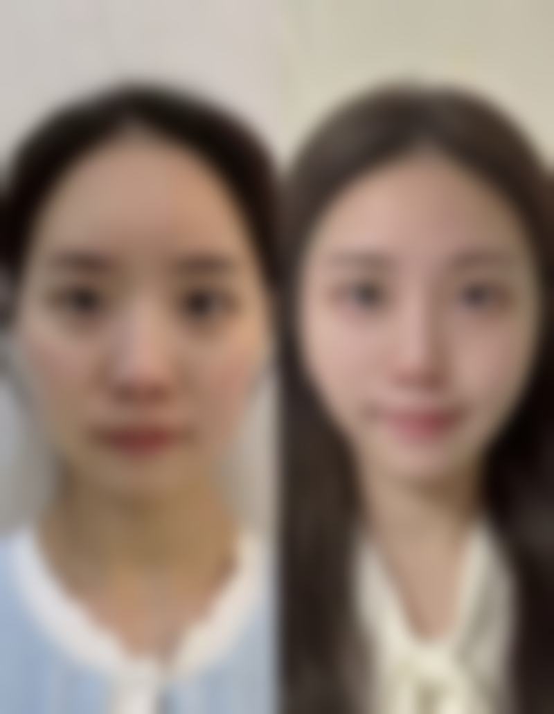 北京澄真医疗美容诊所张桦医生收费价格