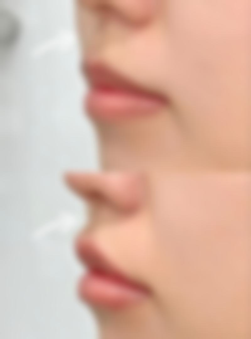 南京瑜雅医疗美容诊所正规吗？