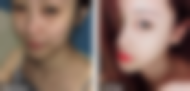 杭州瑞丽医疗美容医院宋建良医生预约挂号指南