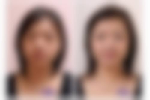 东莞科医能医疗美容门诊部怎么预约