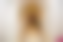 潍坊华美医疗美容医院郭光科医生吸脂手术技术怎么样？