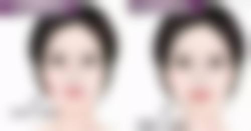 问题六：在选择隆胸假体品牌时，除了品牌本身，还需要注意什么？