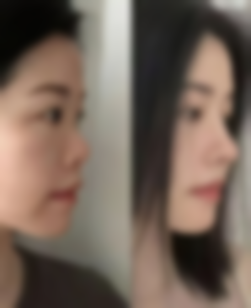 北京伊摩整形怎么预约