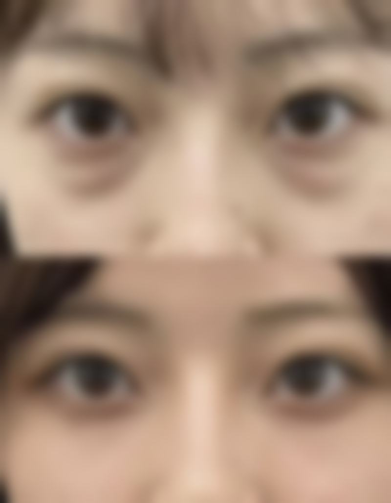 北京伊摩整形口碑评价怎么样？