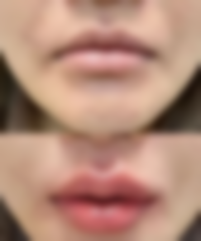 重庆爱思特整形美容医院口碑评价怎么样？