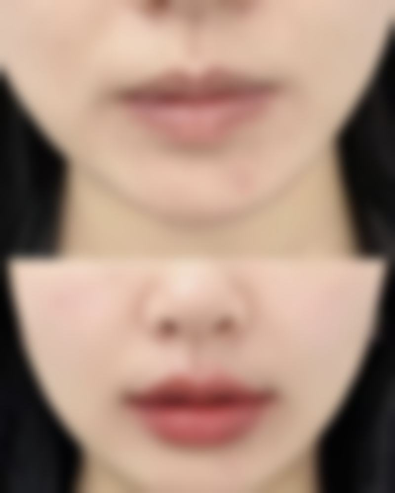 金华文荣医院整形美容科怎么预约