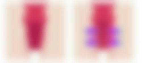 成都悦丽美科医疗美容诊所口碑评价怎么样？