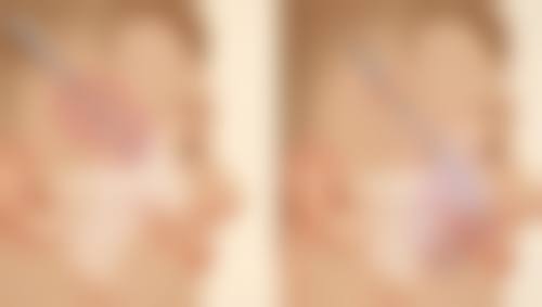 韩国MGTY整形外科朴正宪医生擅长项目