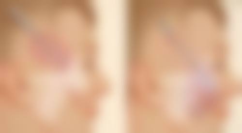 潜江亚美医疗美容诊所口碑评价怎么样？