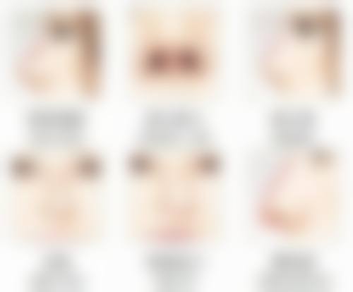 唐山菩瑞提医疗美容诊所饶颖慧医生擅长项目