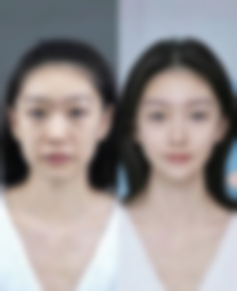 河南大学附属南石医院烧伤整形美容中 心闫静医生预约挂号指南