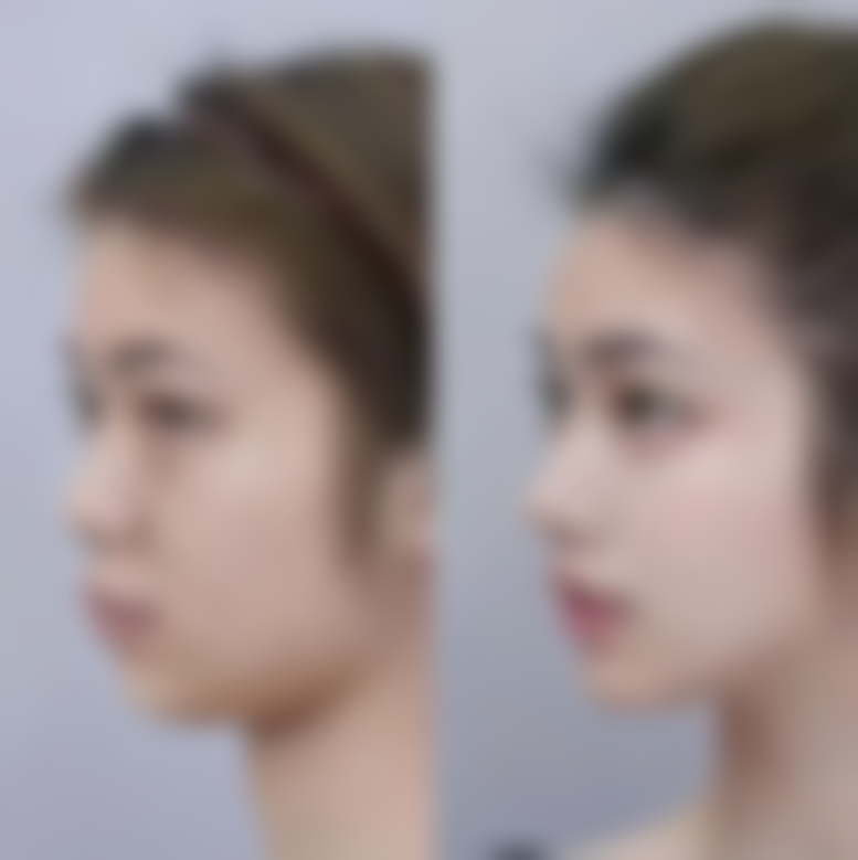 韩国MGTY整形外科朴正宪医生预约挂号指南