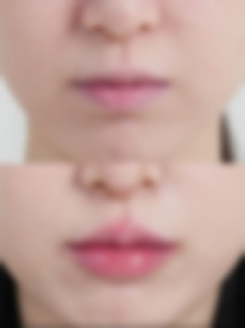 大庆市第五医院整形美容科收费价格表