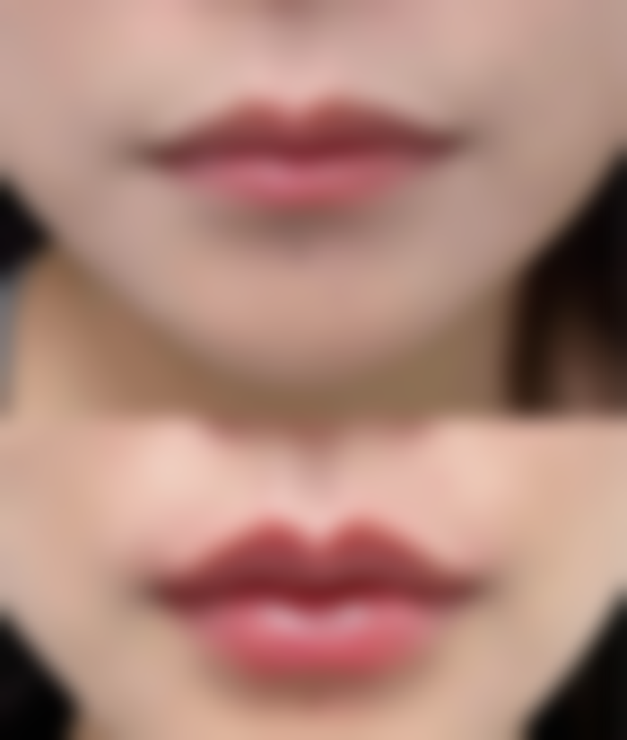 韩国丽朵皮肤科李乾镐医生预约挂号指南