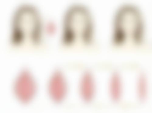 秦皇岛巧致整形美容医院周海燕医生激光祛斑技术怎么样？