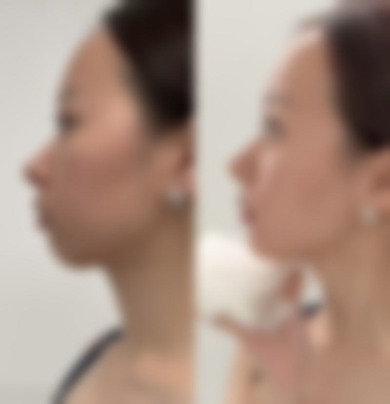 北京四美整形美容医院怎么预约