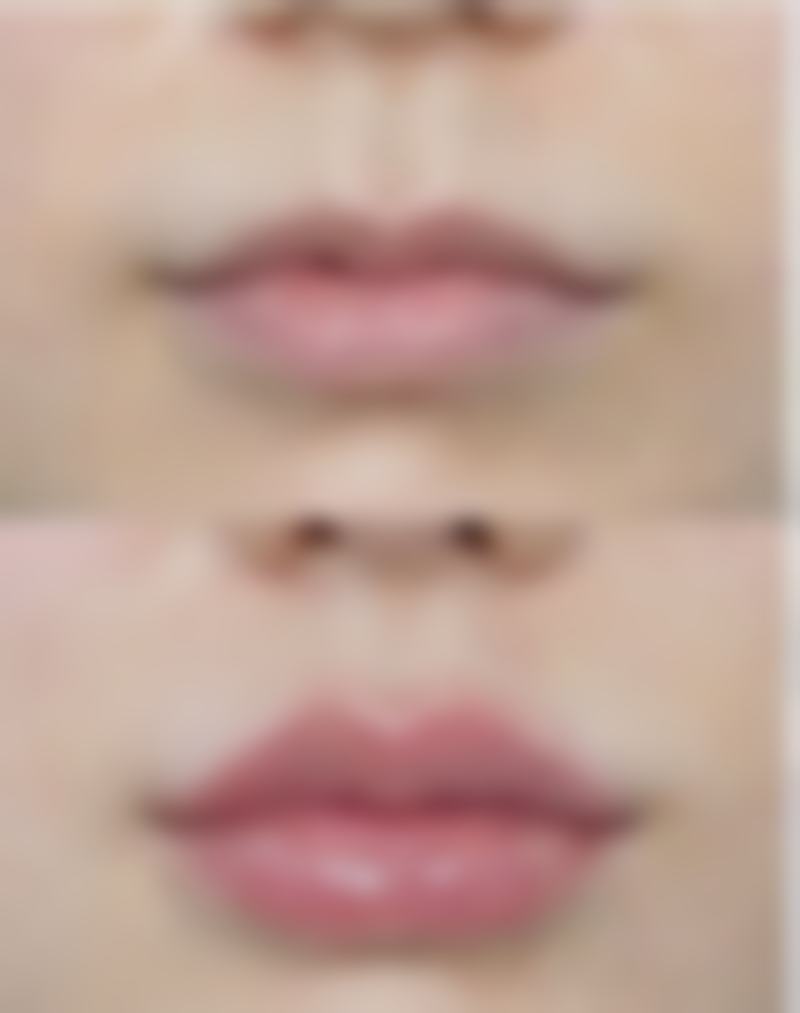 株洲市一医院烧伤整形外科苏开新医生擅长项目