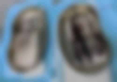 哈尔滨安卓儿整形医院收费价格表