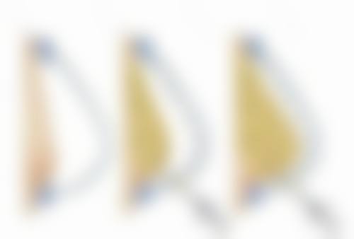 有没有方法可以让单眼皮变成双眼皮？