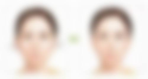 天生的双眼皮或单眼皮会改变吗？