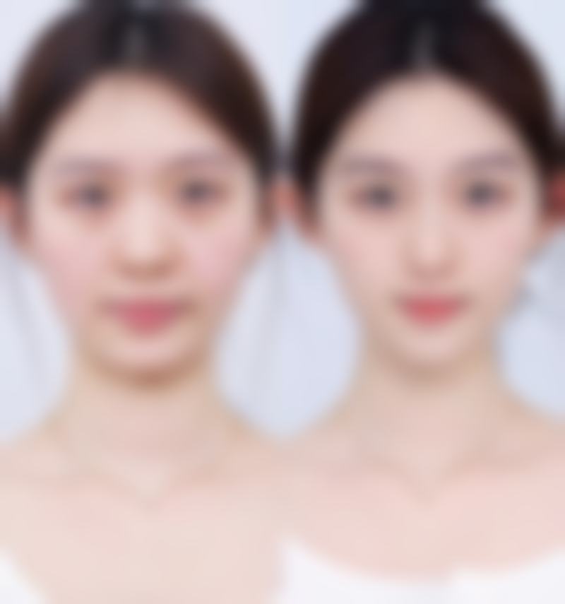 杭州颜久生医疗美容诊所赵卿医生患者评价