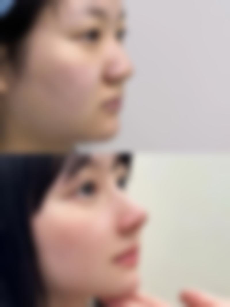 手术疤痕要怎么修复？揭秘有效的修复方法与护理技巧！激光、药物修复哪个更适合你？ 