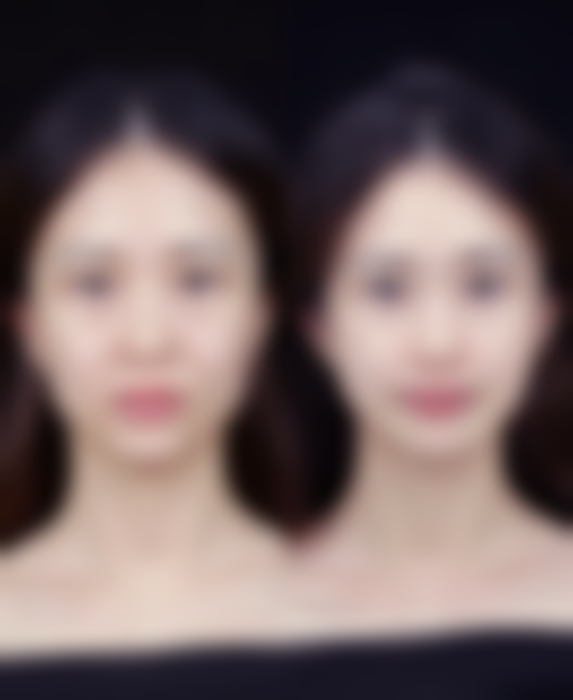 有哪些法定推荐的修复治疗方法呢？