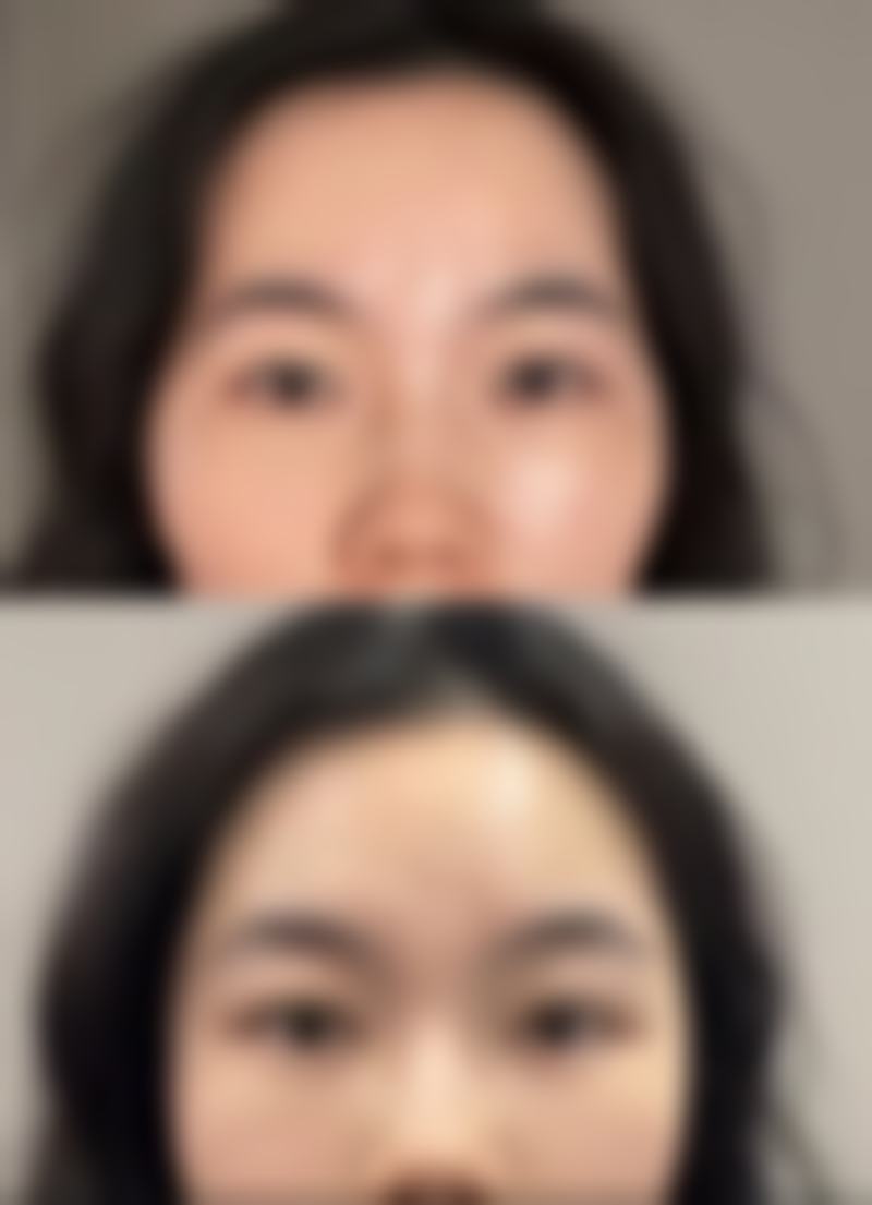 杭州颜久生医疗美容诊所赵卿医生眼部整形技术怎么样？