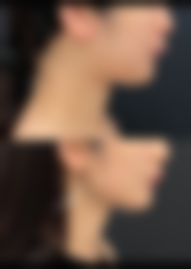 常见的副作用有哪些呢？