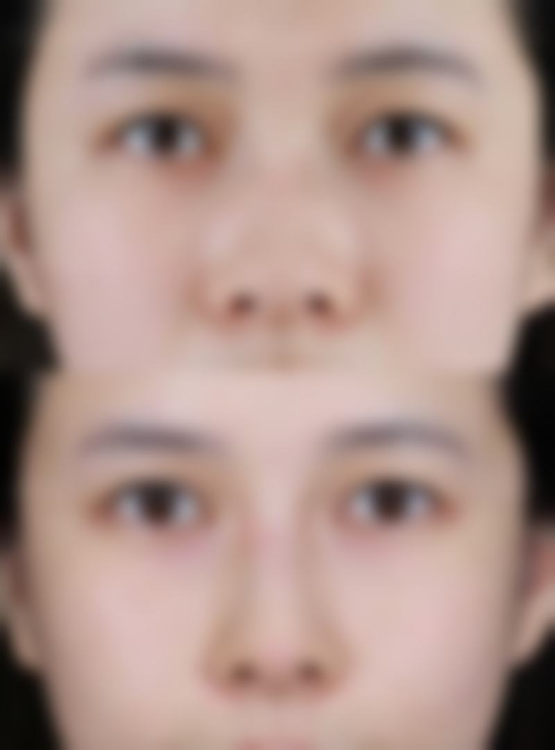 河北省人民医院(医疗美容科)口碑评价怎么样？