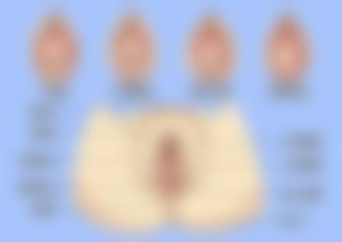 评上伤残等级有哪些额外赔偿？