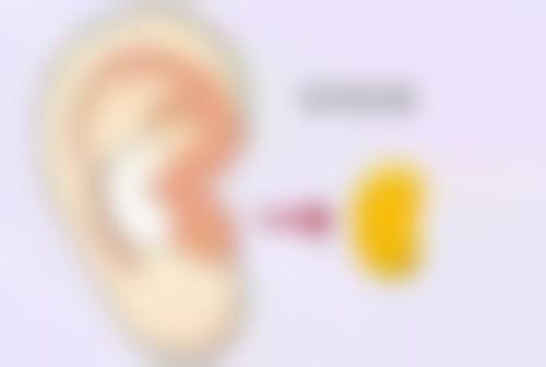 有哪些手术疤痕淡化/改善方案？