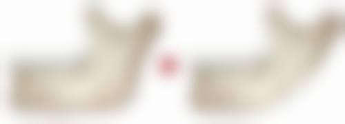 郑州欣奕中医院整形科口碑评价怎么样？