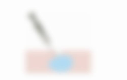 打瘦脸针后意外怀孕，能自行用药吗？