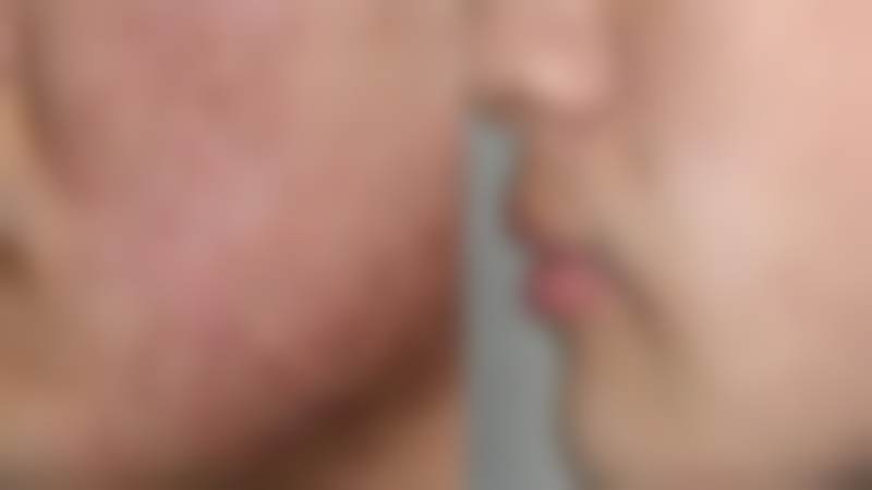 韩国美姿（mizslim）吸脂医院张育军 医生预约挂号指南