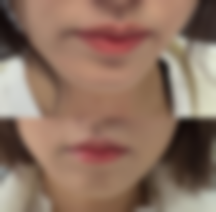 郑州欣奕中医院整形科怎么预约