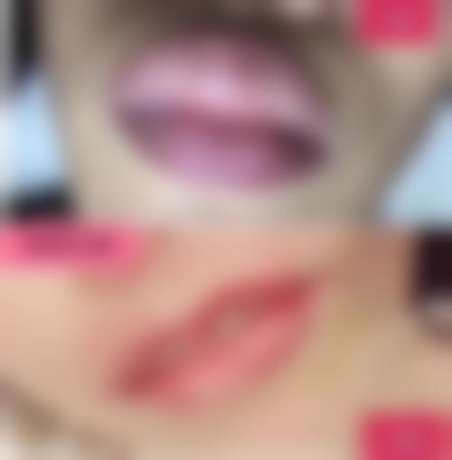 韩国healiv希里芙皮肤科口碑评价怎么样？