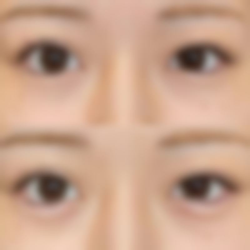 青岛海妙华美整形医院怎么预约