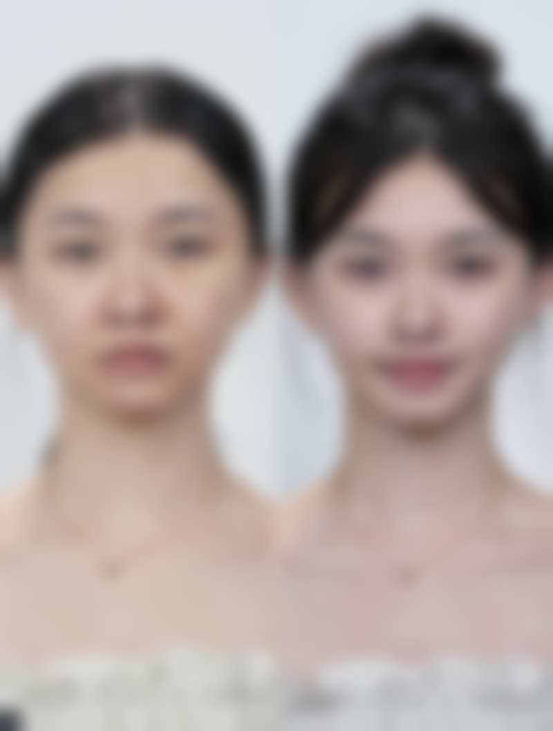 方法五：专精护理与及时就医