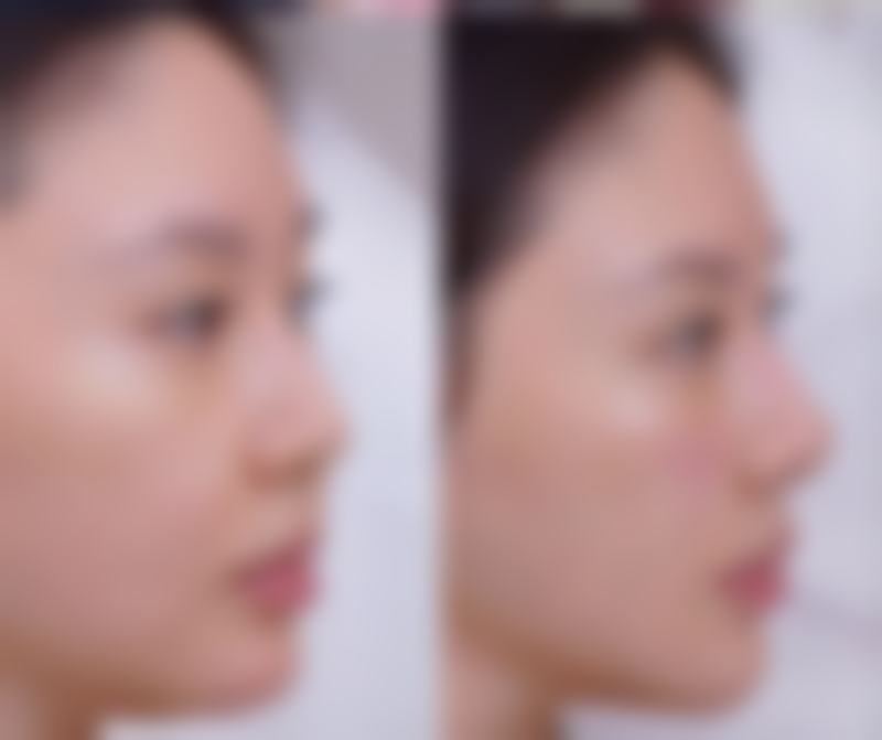 厦门思明瑞麒麟医疗美容诊所富勒烯·熬夜针技术有哪些优势？