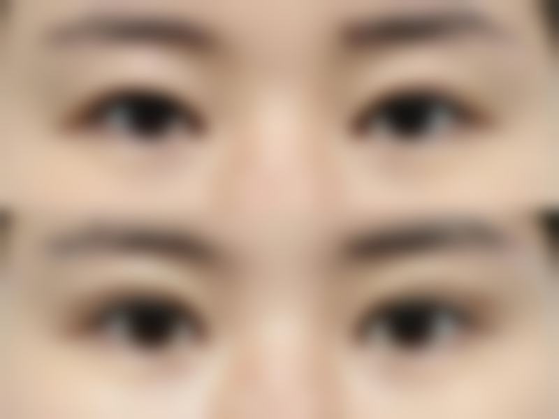 方法二：外用药物来帮忙