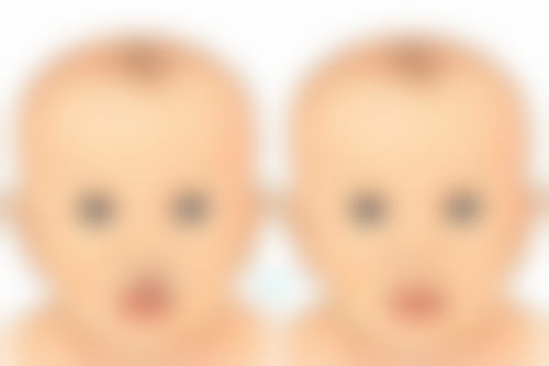 双眼皮可以刮出来吗？揭秘真实效果与专业建议！刮出的双眼皮能维持多久？有啥风险？ 