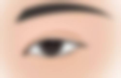 成都悦丽美科医疗美容诊所涂宇腾医生嫩肤技术怎么样？