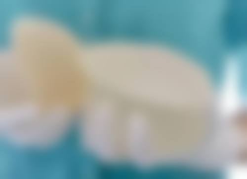 怎样才能拥有持久的双眼皮？